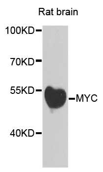 MYC / c-Myc Antibody - Western blot analysis of extracts of rat brain, using MYC antibody at 1:500 dilution. The secondary antibody used was an HRP Goat Anti-Rabbit IgG (H+L) at 1:10000 dilution. Lysates were loaded 25ug per lane and 3% nonfat dry milk in TBST was used for blocking. An ECL Kit was used for detection and the exposure time was 30s.