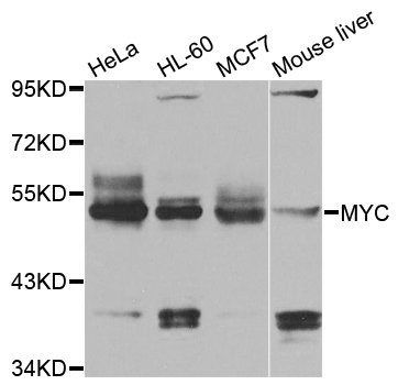 MYC / c-Myc Antibody - Western blot analysis of extracts of various cell lines, using MYC antibodyat 1:1000 dilution. The secondary antibody used was an HRP Goat Anti-Rabbit IgG (H+L) at 1:10000 dilution. Lysates were loaded 25ug per lane and 3% nonfat dry milk in TBST was used for blocking. An ECL Kit was used for detection and the exposure time was 1s.
