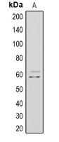 MYC / c-Myc Antibody - Western blot analysis of c-Myc expression in HeLa (A) whole cell lysates.