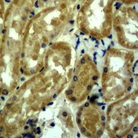 MYC / c-Myc Antibody - Immunohistochemical analysis of c-Myc staining in mouse kidney formalin fixed paraffin embedded tissue section. The section was pre-treated using heat mediated antigen retrieval with sodium citrate buffer (pH 6.0). The section was then incubated with the antibody at room temperature and detected using an HRP conjugated compact polymer system. DAB was used as the chromogen. The section was then counterstained with hematoxylin and mounted with DPX.