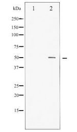 MYC / c-Myc Antibody - Western blot of MYC expression in Forskolin treated HeLa whole cell lysates,The lane on the left is treated with the antigen-specific peptide.