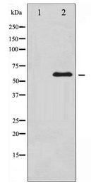 MYC / c-Myc Antibody - Western blot of MYC expression in ovary cancer whole cell lysates,The lane on the left is treated with the antigen-specific peptide.