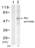 MYC / c-Myc Antibody - Detection of Myc (phosphoThr358) in extracts of HT29 cells untreated or treated with UV.