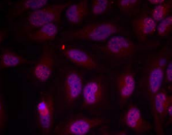 MYC / c-Myc Antibody - Detection of Myc (phospho-Thr358 in methanol-fixed HeLa cells.