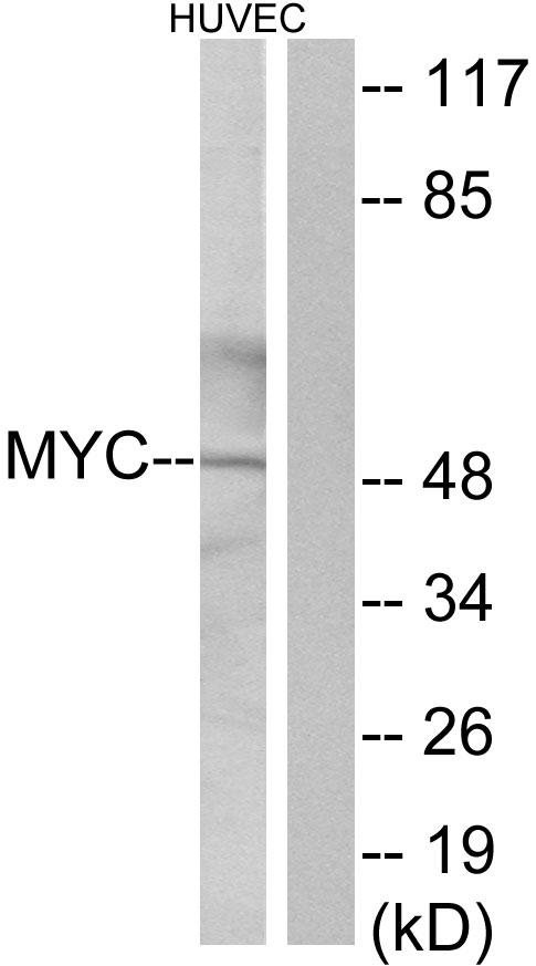 MYC / c-Myc Antibody - Western blot analysis of extracts from HUVEC cells, using Myc antibody.