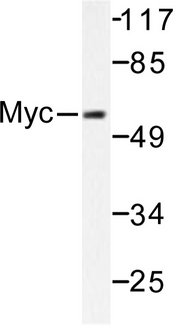 MYC / c-Myc Antibody - Western blot of Myc (K52) pAb in extracts from ovary cancer cells.