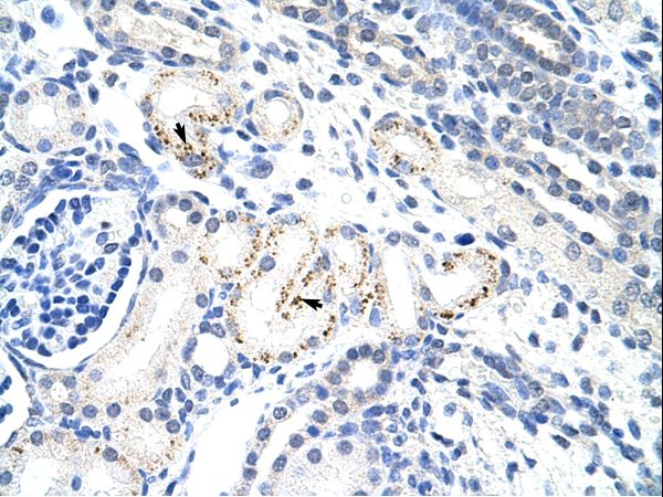 MYC / c-Myc Antibody - MYC / c-Myc antibody ARP38156_T100-AAA88092-MYC (myc protein) Antibody was used in IHC to stain formalin-fixed, paraffin-embedded human kidney.  This image was taken for the unconjugated form of this product. Other forms have not been tested.