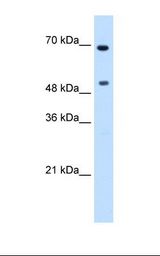 MYC / c-Myc Antibody - Transfected 293T cell lysate. Antibody concentration: 0.0625 ug/ml. Gel concentration: 12%.  This image was taken for the unconjugated form of this product. Other forms have not been tested.