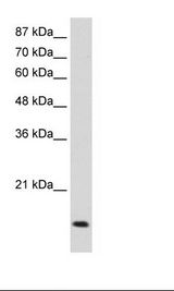 MYC / c-Myc Antibody - Jurkat Cell Lysate.  This image was taken for the unconjugated form of this product. Other forms have not been tested.