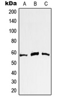 MYC / c-Myc Antibody - Western blot analysis of c-Myc expression in A431 (A); Jurkat (B); HeLa (C) whole cell lysates.