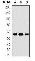 MYC / c-Myc Antibody - Western blot analysis of c-Myc expression in K562 (A); HeLa (B); PC12 (C) whole cell lysates.