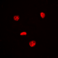 MYC / c-Myc Antibody - Immunofluorescent analysis of c-Myc staining in HeLa cells. Formalin-fixed cells were permeabilized with 0.1% Triton X-100 in TBS for 5-10 minutes and blocked with 3% BSA-PBS for 30 minutes at room temperature. Cells were probed with the primary antibody in 3% BSA-PBS and incubated overnight at 4 deg C in a humidified chamber. Cells were washed with PBST and incubated with a DyLight 594-conjugated secondary antibody (red) in PBS at room temperature in the dark. DAPI was used to stain the cell nuclei (blue).