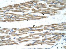 MYC / c-Myc Antibody - MYC / c-Myc antibody MYC(myc protein) Antibody was used in IHC to stain formalin-fixed, paraffin-embedded human muscle.  This image was taken for the unconjugated form of this product. Other forms have not been tested.