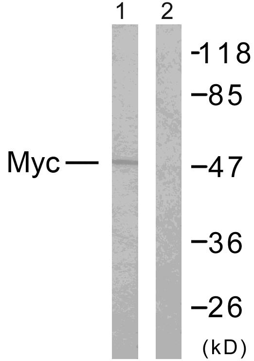 MYC / c-Myc Antibody - Western blot analysis of extracts from NIH/3T3 cells using Myc (Ab-358) antibody.