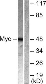 MYC / c-Myc Antibody - Western blot analysis of extracts from Hela cells treated with Forskolin (40nM, 30min), using Myc (Ab-62) antibody ( Line 1 and 2).