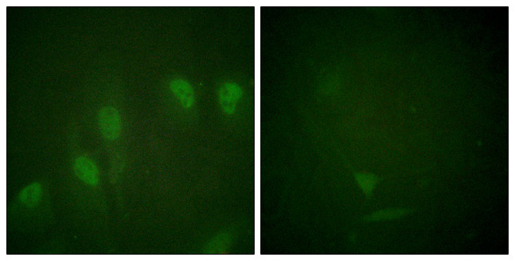 MYC / c-Myc Antibody - Immunofluorescence analysis of HeLa cells treated with Forskolin 40nM 30', using Myc (Phospho-Ser62) Antibody. The picture on the right is blocked with the phospho peptide.