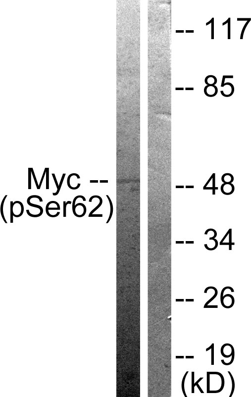 MYC / c-Myc Antibody - Western blot analysis of lysates from 293 cells treated with Forskolin 40nM 30', using Myc (Phospho-Ser62) Antibody. The lane on the right is blocked with the phospho peptide.