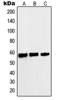 MYC / c-Myc Antibody - Western blot analysis of c-Myc (pS62) expression in A431 (A); HeLa (B); Jurkat (C) whole cell lysates.