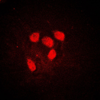 MYC / c-Myc Antibody - Immunofluorescent analysis of c-Myc (pS62) staining in HeLa cells. Formalin-fixed cells were permeabilized with 0.1% Triton X-100 in TBS for 5-10 minutes and blocked with 3% BSA-PBS for 30 minutes at room temperature. Cells were probed with the primary antibody in 3% BSA-PBS and incubated overnight at 4 C in a humidified chamber. Cells were washed with PBST and incubated with a DyLight 594-conjugated secondary antibody (red) in PBS at room temperature in the dark. DAPI was used to stain the cell nuclei (blue).