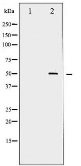 MYC / c-Myc Antibody - Western blot of Myc phosphorylation expression in Forskolin treated 293 whole cell lysates,The lane on the left is treated with the antigen-specific peptide.