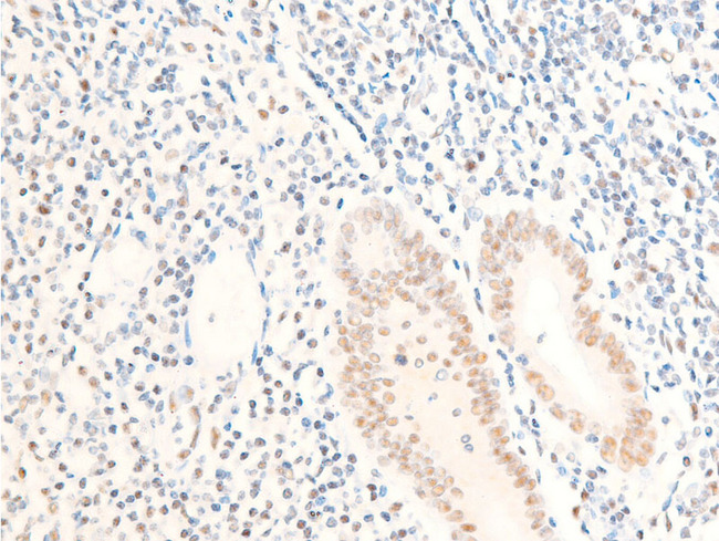 MYC / c-Myc Antibody - 1:100 staining human appendix tissue by IHC-P. The tissue was formaldehyde fixed and a heat mediated antigen retrieval step in citrate buffer was performed. The tissue was then blocked and incubated with the antibody for 1.5 hours at 22°C. An HRP conjugated goat anti-rabbit antibody was used as the secondary.