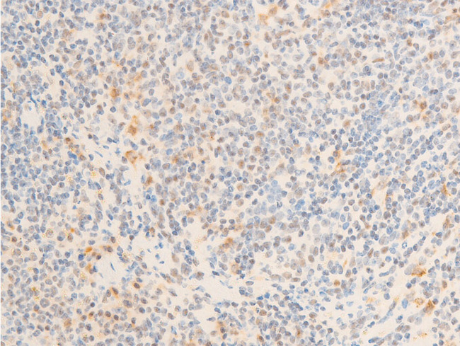 MYC / c-Myc Antibody - 1:100 staining mouse spleen tissue by IHC-P. The tissue was formaldehyde fixed and a heat mediated antigen retrieval step in citrate buffer was performed. The tissue was then blocked and incubated with the antibody for 1.5 hours at 22°C. An HRP conjugated goat anti-rabbit antibody was used as the secondary.