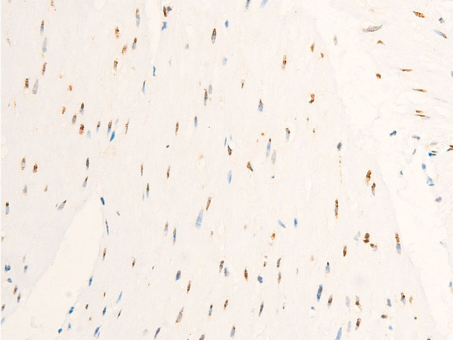 MYC / c-Myc Antibody - 1:100 staining human heart tissue by IHC-P. The tissue was formaldehyde fixed and a heat mediated antigen retrieval step in citrate buffer was performed. The tissue was then blocked and incubated with the antibody for 1.5 hours at 22°C. An HRP conjugated goat anti-rabbit antibody was used as the secondary.