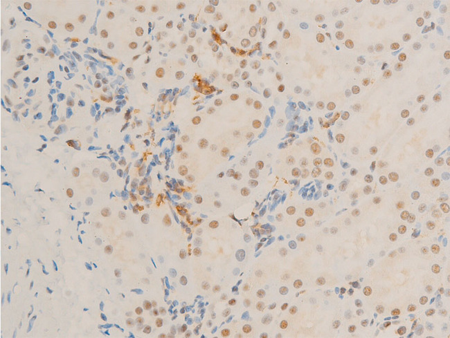 MYC / c-Myc Antibody - 1:100 staining rat kidney tissue by IHC-P. The tissue was formaldehyde fixed and a heat mediated antigen retrieval step in citrate buffer was performed. The tissue was then blocked and incubated with the antibody for 1.5 hours at 22°C. An HRP conjugated goat anti-rabbit antibody was used as the secondary.