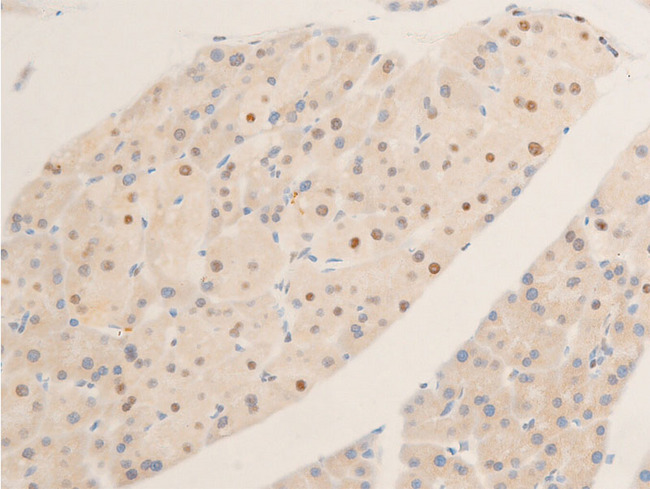 MYC / c-Myc Antibody - 1:100 staining mouse pancreas tissue by IHC-P. The tissue was formaldehyde fixed and a heat mediated antigen retrieval step in citrate buffer was performed. The tissue was then blocked and incubated with the antibody for 1.5 hours at 22°C. An HRP conjugated goat anti-rabbit antibody was used as the secondary.