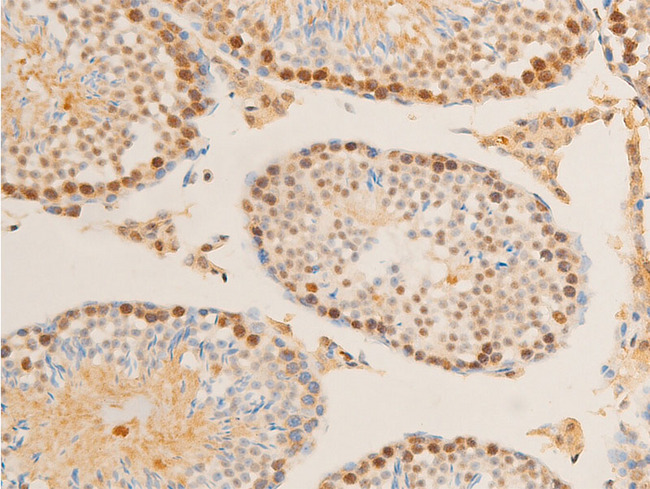 MYC / c-Myc Antibody - 1:100 staining mouse testis tissue by IHC-P. The tissue was formaldehyde fixed and a heat mediated antigen retrieval step in citrate buffer was performed. The tissue was then blocked and incubated with the antibody for 1.5 hours at 22°C. An HRP conjugated goat anti-rabbit antibody was used as the secondary.