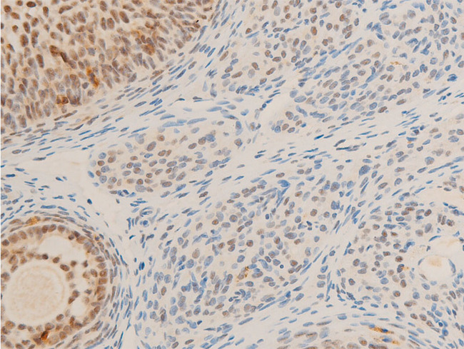 MYC / c-Myc Antibody - 1:100 staining rat ovarian tissue by IHC-P. The tissue was formaldehyde fixed and a heat mediated antigen retrieval step in citrate buffer was performed. The tissue was then blocked and incubated with the antibody for 1.5 hours at 22°C. An HRP conjugated goat anti-rabbit antibody was used as the secondary.