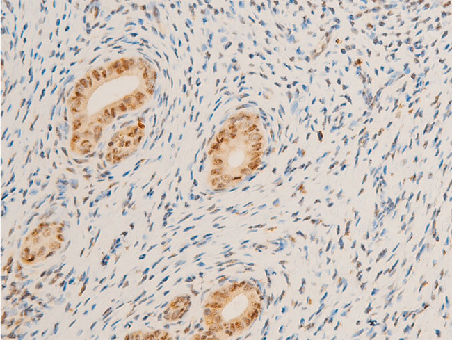 MYC / c-Myc Antibody - 1:100 staining rat uterine tissue by IHC-P. The tissue was formaldehyde fixed and a heat mediated antigen retrieval step in citrate buffer was performed. The tissue was then blocked and incubated with the antibody for 1.5 hours at 22°C. An HRP conjugated goat anti-rabbit antibody was used as the secondary.