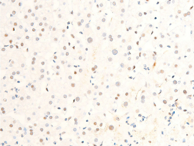 MYC / c-Myc Antibody - 1:100 staining human liver tissue by IHC-P. The tissue was formaldehyde fixed and a heat mediated antigen retrieval step in citrate buffer was performed. The tissue was then blocked and incubated with the antibody for 1.5 hours at 22°C. An HRP conjugated goat anti-rabbit antibody was used as the secondary.