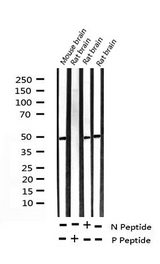 MYC / c-Myc Antibody - Western blot analysis of Phospho-Myc (Ser62) expression in various lysates