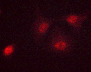 MYC / c-Myc Antibody - Staining HeLa cells treated with Forskolin 40nM 30' cells by IF/ICC. The samples were fixed with PFA and permeabilized in 0.1% saponin prior to blocking in 10% serum for 45 min at 37°C. The primary antibody was diluted 1/400 and incubated with the sample for 1 hour at 37°C. A Alexa Fluor® 594 conjugated goat polyclonal to rabbit IgG (H+L), diluted 1/600 was used as secondary antibody.