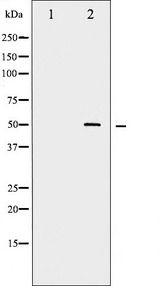 MYC / c-Myc Antibody - Western blot analysis of Myc phosphorylation expression in Forskolin treated 293 whole cells lysates. The lane on the left is treated with the antigen-specific peptide.