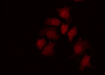 MYC / c-Myc Antibody - Staining 293 cells by IF/ICC. The samples were fixed with PFA and permeabilized in 0.1% Triton X-100, then blocked in 10% serum for 45 min at 25°C. The primary antibody was diluted at 1:200 and incubated with the sample for 1 hour at 37°C. An Alexa Fluor 594 conjugated goat anti-rabbit IgG (H+L) Ab, diluted at 1/600, was used as the secondary antibody.