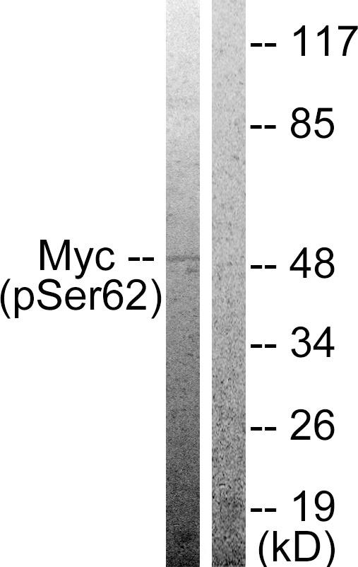 MYC / c-Myc Antibody - Western blot analysis of extracts from 293 cells treated with Forskolin (40nM, 30mins), using Myc (phospho-Ser62) antibody.