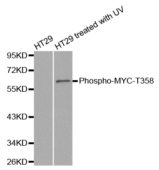 MYC / c-Myc Antibody - Western blot analysis of extracts from HT29 cells untreated or treated with UV.