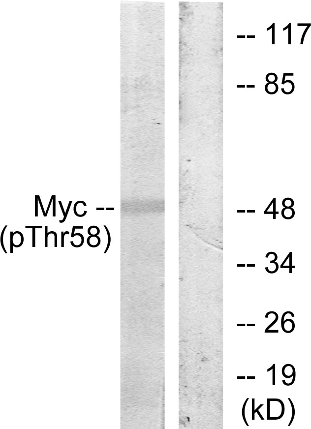 MYC / c-Myc Antibody - Western blot analysis of lysates from ovary cancer, using Myc (Phospho-Thr58) Antibody. The lane on the right is blocked with the phospho peptide.