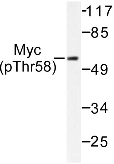 MYC / c-Myc Antibody - Western blot of p-Myc (T58) pAb in extracts from ovary cancer.