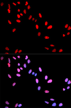 MYC / c-Myc Antibody - Immunofluorescence analysis of U2OS cells.
