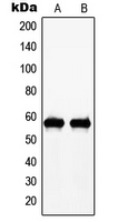 MYC / c-Myc Antibody - Western blot analysis of c-Myc (pT58) expression in A431 (A); HeLa (B) whole cell lysates.
