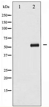 MYC / c-Myc Antibody - Western blot of Myc phosphorylation expression in ovary cancer whole cell lysates,The lane on the left is treated with the antigen-specific peptide.