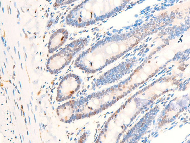 MYC / c-Myc Antibody - 1:100 staining rat Intestinal tissue by IHC-P. The tissue was formaldehyde fixed and a heat mediated antigen retrieval step in citrate buffer was performed. The tissue was then blocked and incubated with the antibody for 1.5 hours at 22°C. An HRP conjugated goat anti-rabbit antibody was used as the secondary.