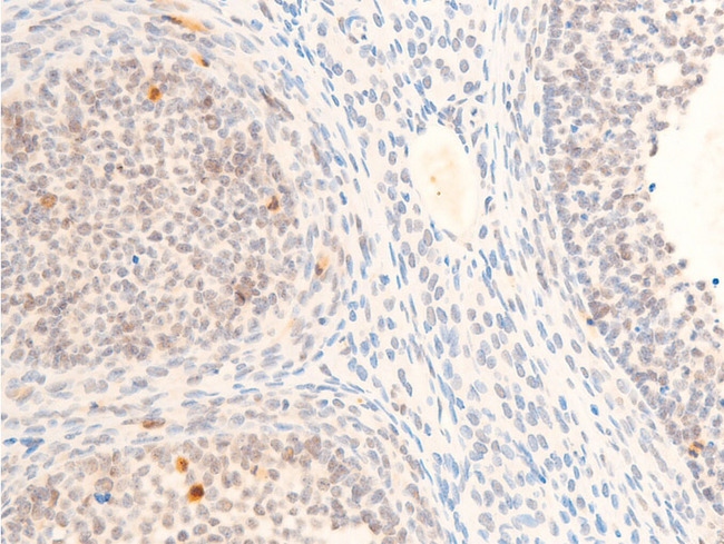 MYC / c-Myc Antibody - 1:100 staining rat ovarian tissue by IHC-P. The tissue was formaldehyde fixed and a heat mediated antigen retrieval step in citrate buffer was performed. The tissue was then blocked and incubated with the antibody for 1.5 hours at 22°C. An HRP conjugated goat anti-rabbit antibody was used as the secondary.