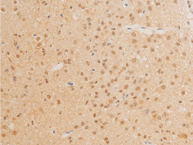 MYC / c-Myc Antibody - 1:100 staining mouse brain tissue by IHC-P. The tissue was formaldehyde fixed and a heat mediated antigen retrieval step in citrate buffer was performed. The tissue was then blocked and incubated with the antibody for 1.5 hours at 22°C. An HRP conjugated goat anti-rabbit antibody was used as the secondary.