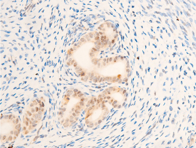 MYC / c-Myc Antibody - 1:100 staining rat uterine tissue by IHC-P. The tissue was formaldehyde fixed and a heat mediated antigen retrieval step in citrate buffer was performed. The tissue was then blocked and incubated with the antibody for 1.5 hours at 22°C. An HRP conjugated goat anti-rabbit antibody was used as the secondary.