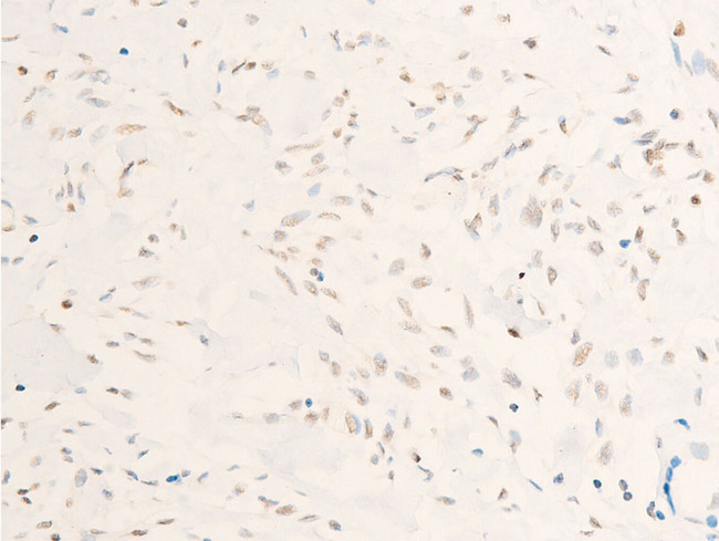 MYC / c-Myc Antibody - 1:100 staining human gastric tissue by IHC-P. The tissue was formaldehyde fixed and a heat mediated antigen retrieval step in citrate buffer was performed. The tissue was then blocked and incubated with the antibody for 1.5 hours at 22°C. An HRP conjugated goat anti-rabbit antibody was used as the secondary.