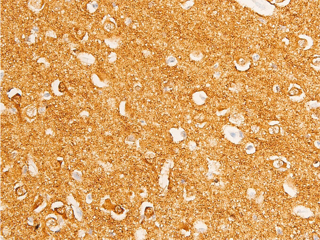 MYC / c-Myc Antibody - 1:100 staining human brain tissue by IHC-P. The tissue was formaldehyde fixed and a heat mediated antigen retrieval step in citrate buffer was performed. The tissue was then blocked and incubated with the antibody for 1.5 hours at 22°C. An HRP conjugated goat anti-rabbit antibody was used as the secondary.